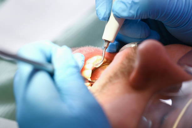 Reliable TX Emergency Dental Service Solutions