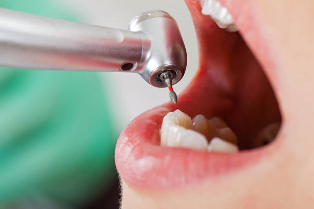 Best Emergency Pediatric Dental Care in Crowley, TX